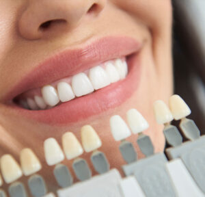Professional Teeth Whitening in Norman, OK
